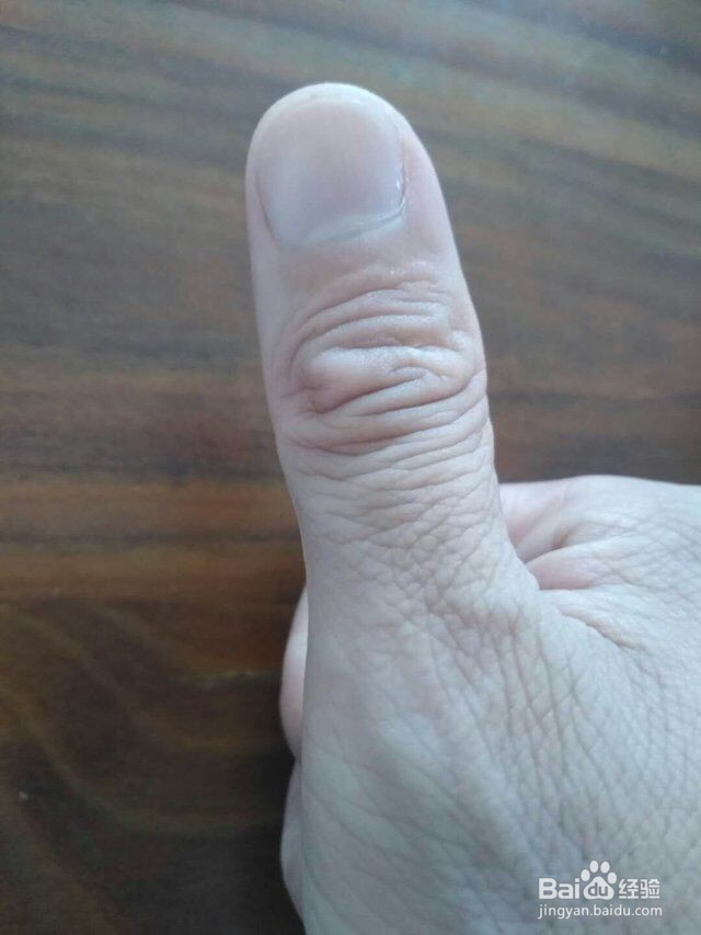 风热感冒夹痰怎么办