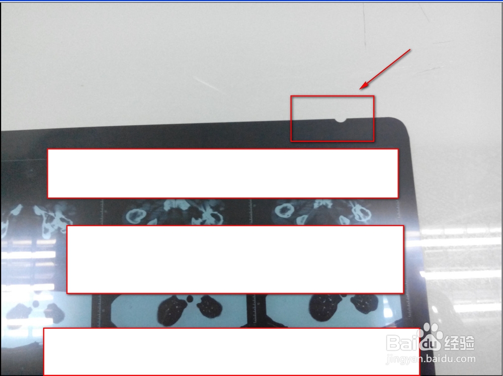 拍摄医院CT，X光片技巧