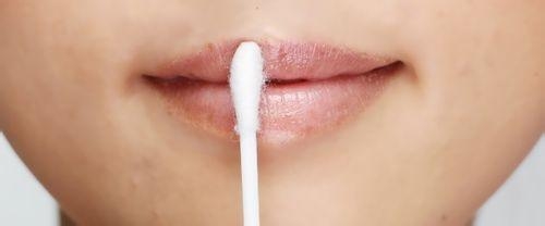 寒冬嘴唇干裂如何应对?