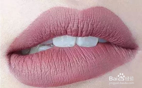 唇纹深怎么办