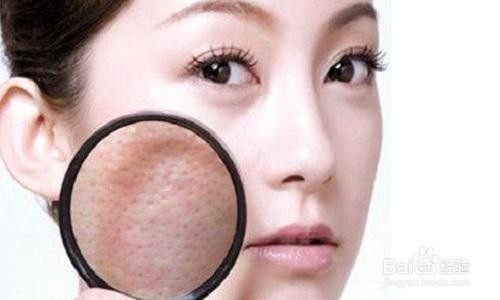 皮肤透露6大健康问题你知道吗?