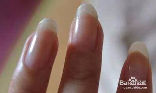 手上出现密密麻麻的小水泡怎么办