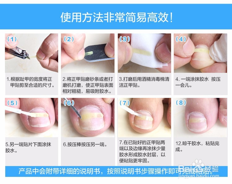 脚趾甲长进肉里了怎么办？？