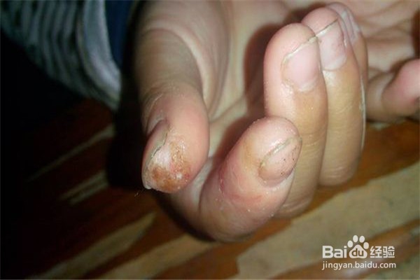 夏季睡凉席的七个注意事项!