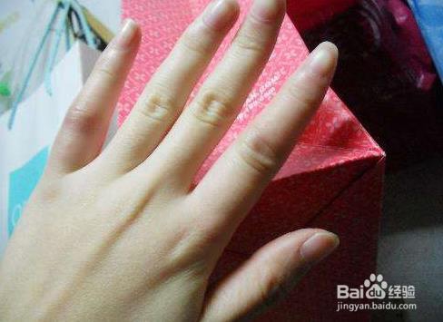 手脚出汗的治疗方法