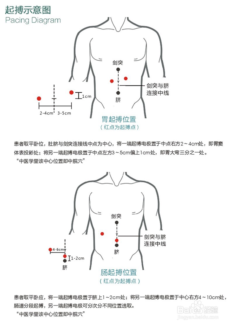 胃肠治疗仪的使用方法