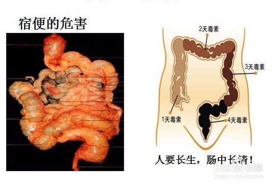 肠道垃圾对身体的危害
