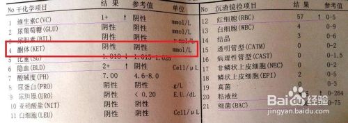 尿液报告单怎么看（干化学方法和镜检）