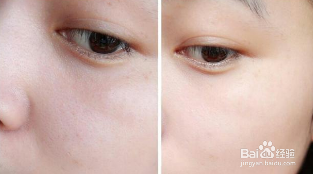 哪些坏习惯会导致毛孔越撑越大？