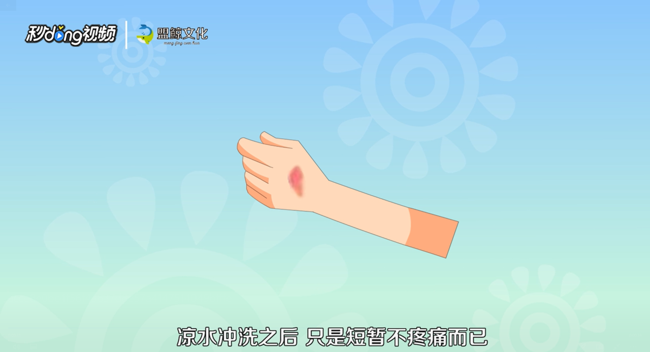 被油溅到皮肤怎么办