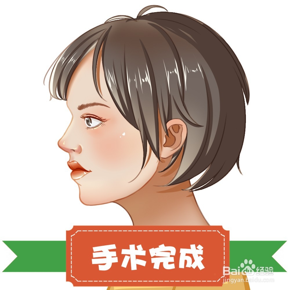隆鼻手术过程