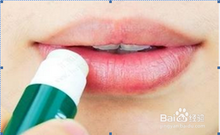 嘴唇脱皮、干裂怎么办