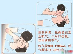 呼吸心跳停止如何进行心肺复苏术