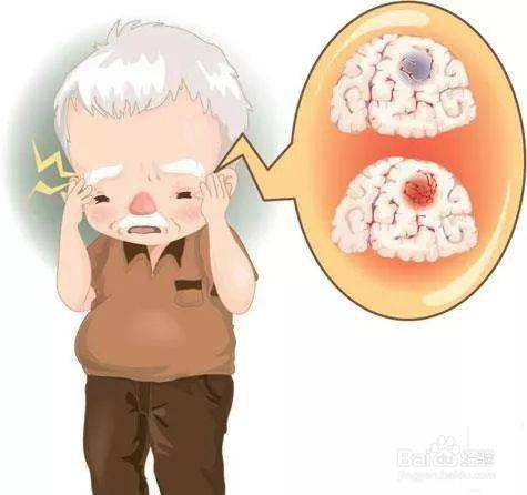 增强记忆力的方法有哪些