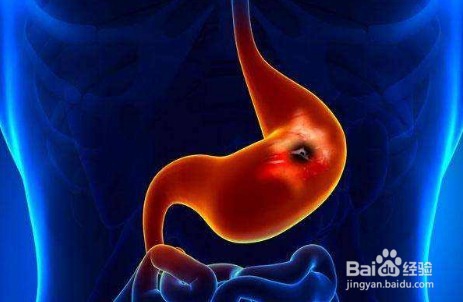 久坐对身体有什么危害？