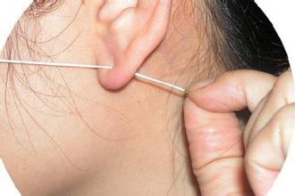 怎样保养耳洞才最好