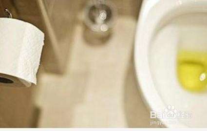 从尿尿的颜色，判断你的身体健康状况