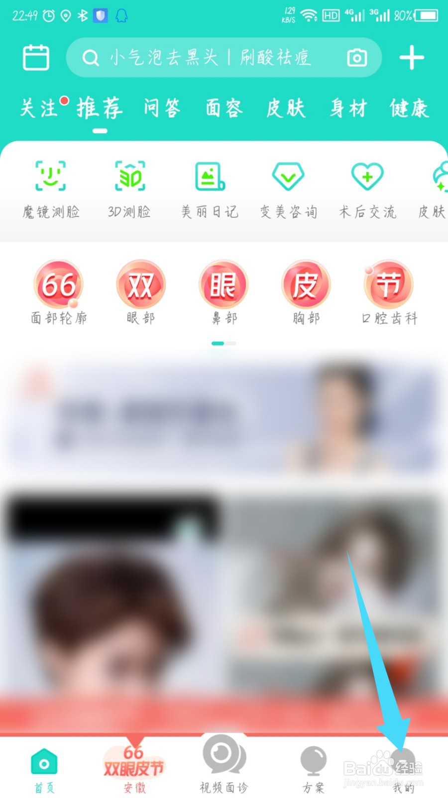新氧医美怎么取消关注