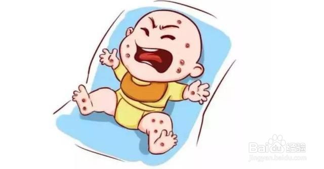 如何辨别宝宝出水痘？