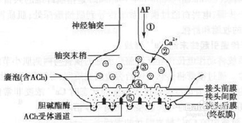 神经-肌肉接头处活检,可见突触后膜皱褶减少,变平坦和其上乙酰胆碱