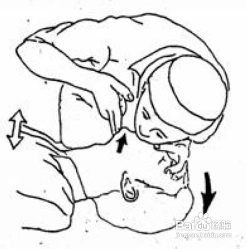 学会急救常识可救心脏病患者一命