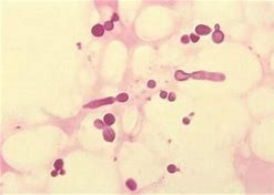 有效的祛痘方法