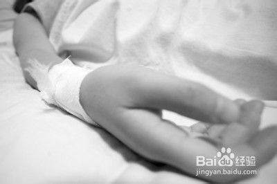 植物神经功能紊乱能引起肠胃疾病