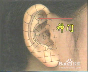 耳穴养生保健