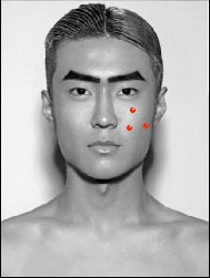 祛痘的小窍门不同部位的祛痘方法