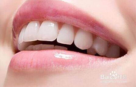 瓷贴面修复后护理