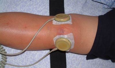 医疗健康 > 外科 3 中等程度的膝关节滑膜炎,我们可以用中医针灸推拿