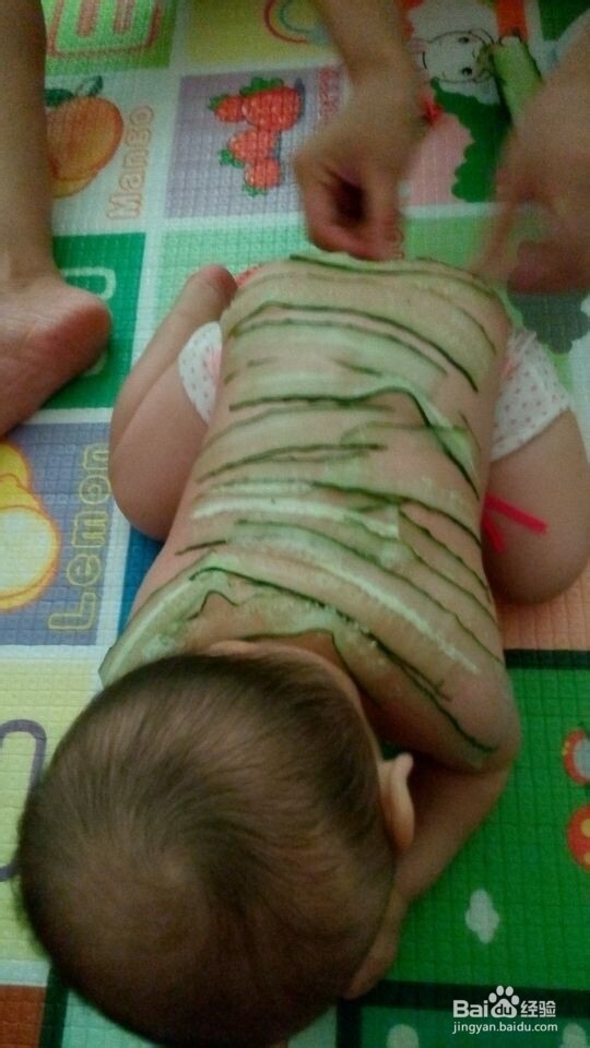 宝宝长痱子怎么办/怎么解决