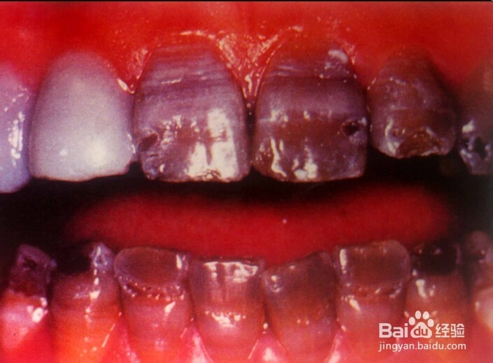 临床口腔牙体牙髓病的知识。