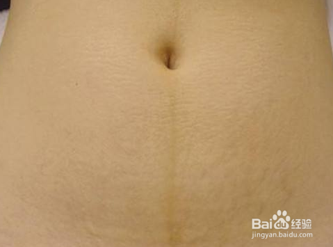 产后如何快速恢复小蛮腰