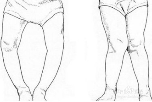 宝宝什么时候不能打预防针