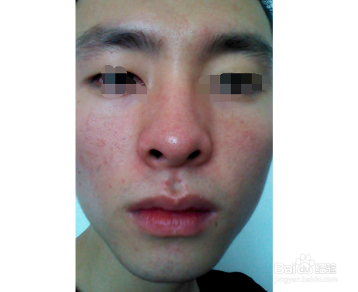 男人肝不好有什么症状