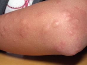 自己动手做一瓶高效无毒的驱蚊水，防蚊诀窍！