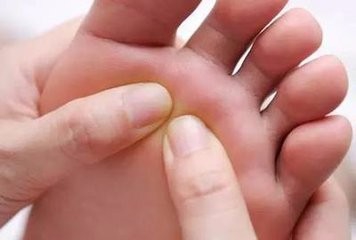 夏天了有脚气怎么办