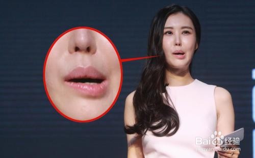 如何认知中风发作前的症状