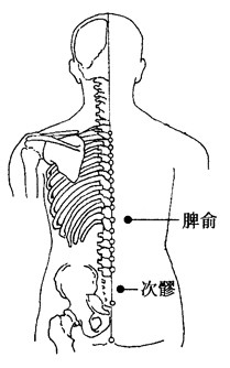 百病刮痧：[39]带下的刮痧疗法