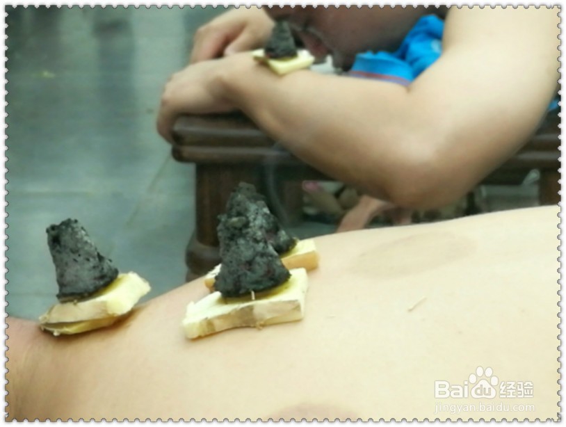 秋季怎样艾灸更健康？