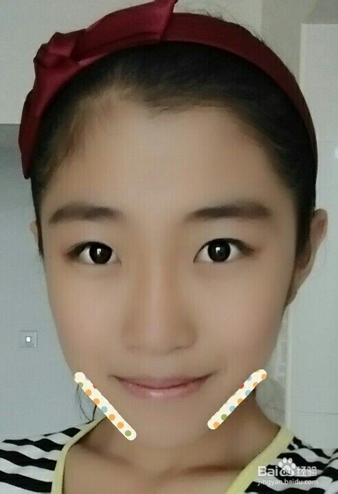 脸上痘痘的位置告诉你哪里出了问题