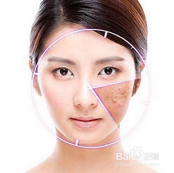 如何判断身体有湿气？