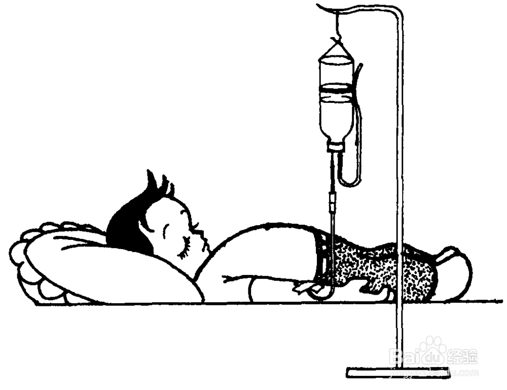 如何抢救急性呼吸窘迫综合征患者