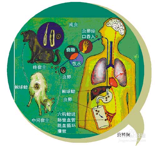 寄生虫是怎样进入人体的？ 科学避免寄生虫病