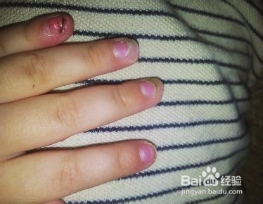 如何排除体内铅