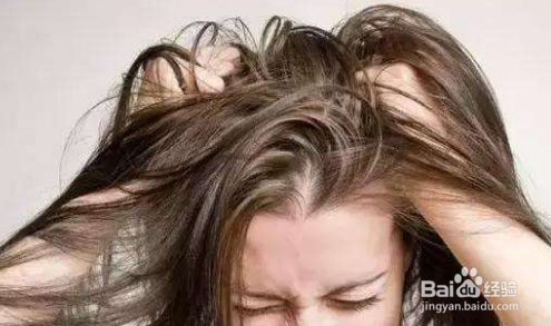 头皮油脂分泌过多怎么办 ?