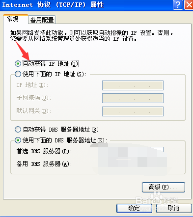 电脑无法自动获取ip地址，不能自动获取ip地址
