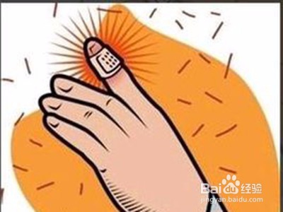 手指甲总是剪出血怎么办