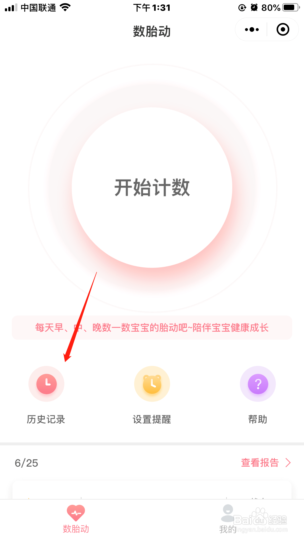 胎动宫缩随手记小程序能看历史记录吗